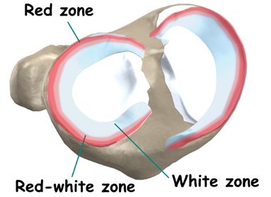knee_meniscus_surgery_anatomy-e1589551990303
