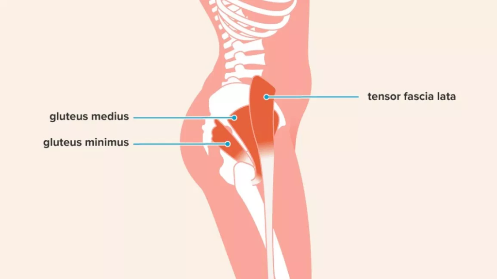 glute tendinopathy