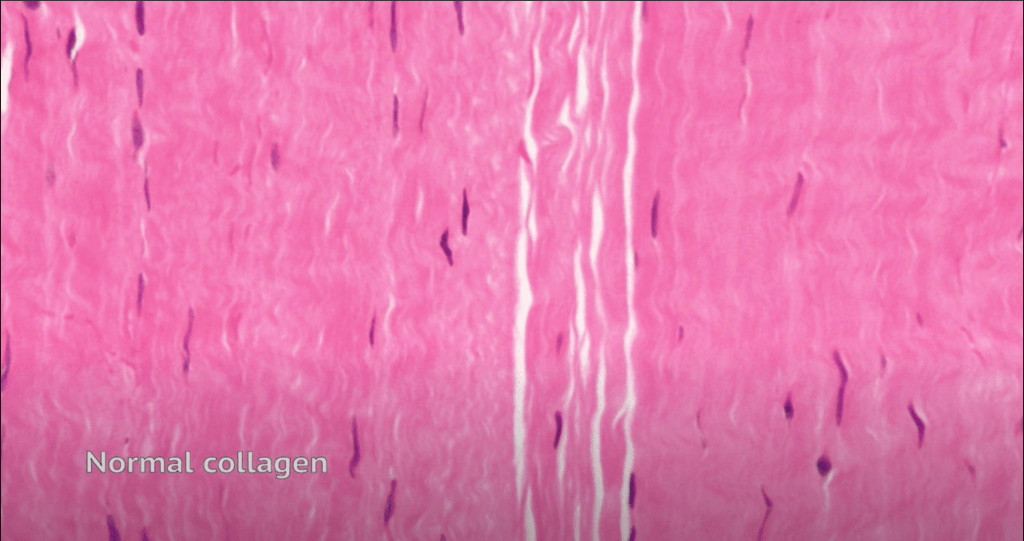 Normal-tendon-1024x541