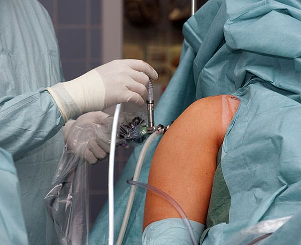 shoulder_arthroscopy_vs_open_surgery_a_fair_comparison_image1