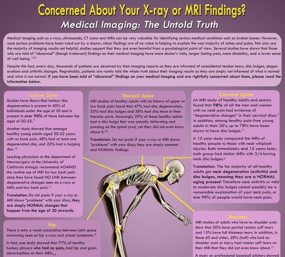Medical-imaging-finding-studies