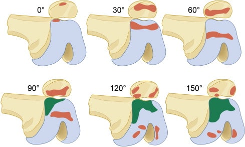 contact-areas-on-underside-of-patella-min