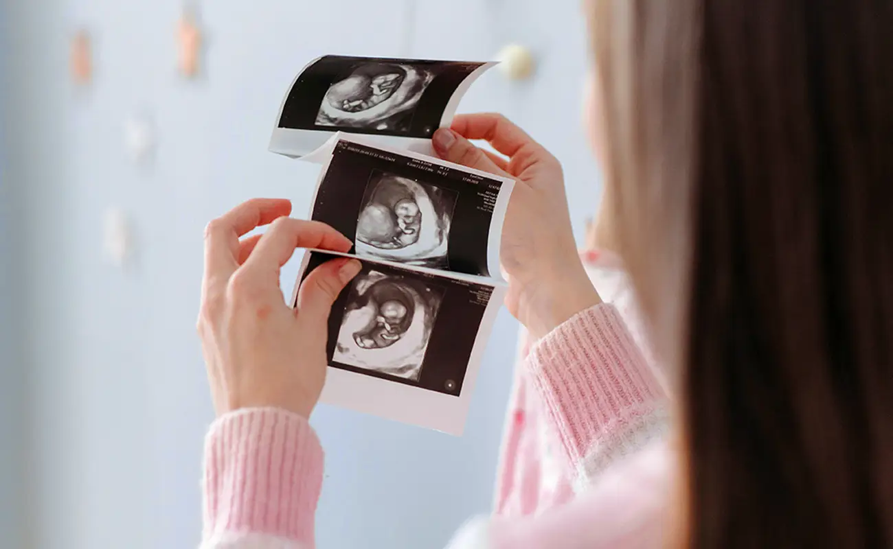 Woman holding and looking at a series of black and white ultrasound images of a developing fetus.