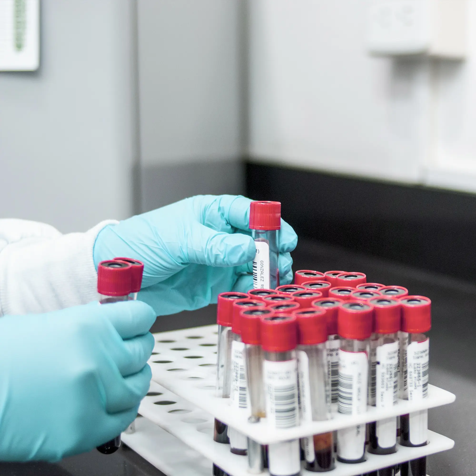 Hands wearing blue gloves handling blood sample tubes with red caps in a lab rack.