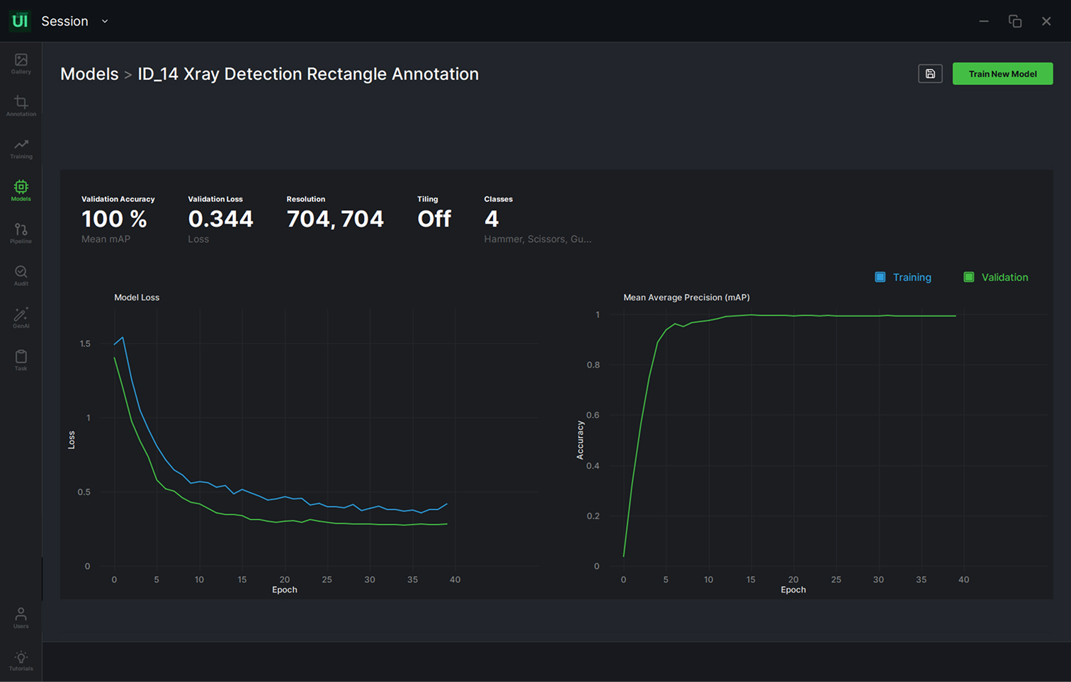 Training and validation loss and IoU curves for the X-ray object detection model.