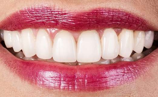 Close-up of a person smiling with white teeth and wearing dark red lipstick.