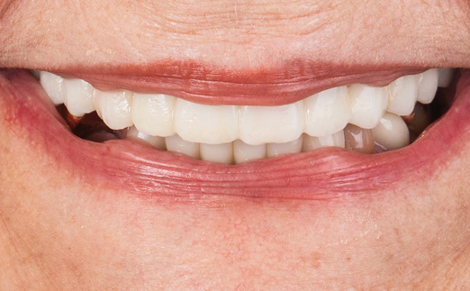 Close-up of a smiling mouth showing white teeth and lips with natural skin texture.
