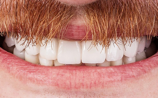 Close-up of a smiling mouth with white teeth and a thick reddish mustache.