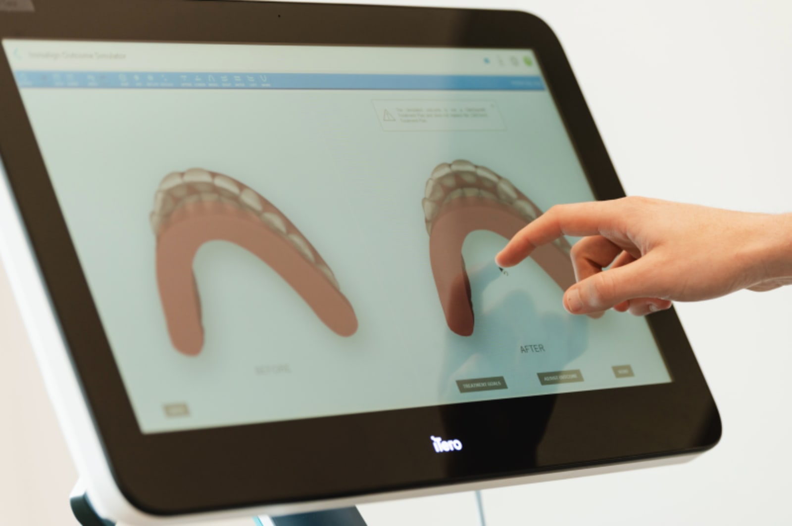 Dentist pointing to digital scan of teeth on touchscreen display during patient consultation.