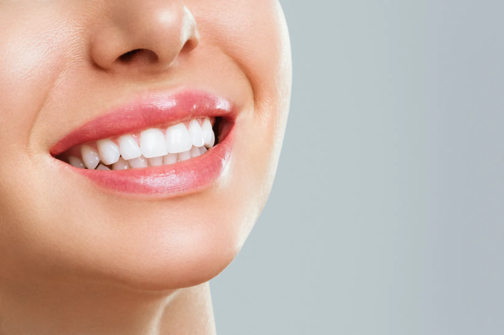 A woman smiling showing her teeth