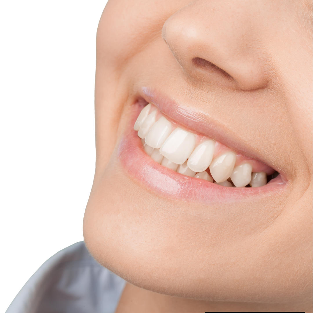 align technology showing perfect smile