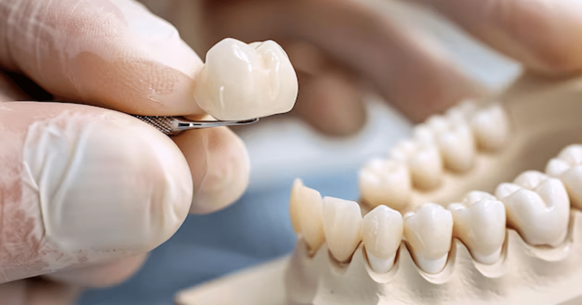 dental crown