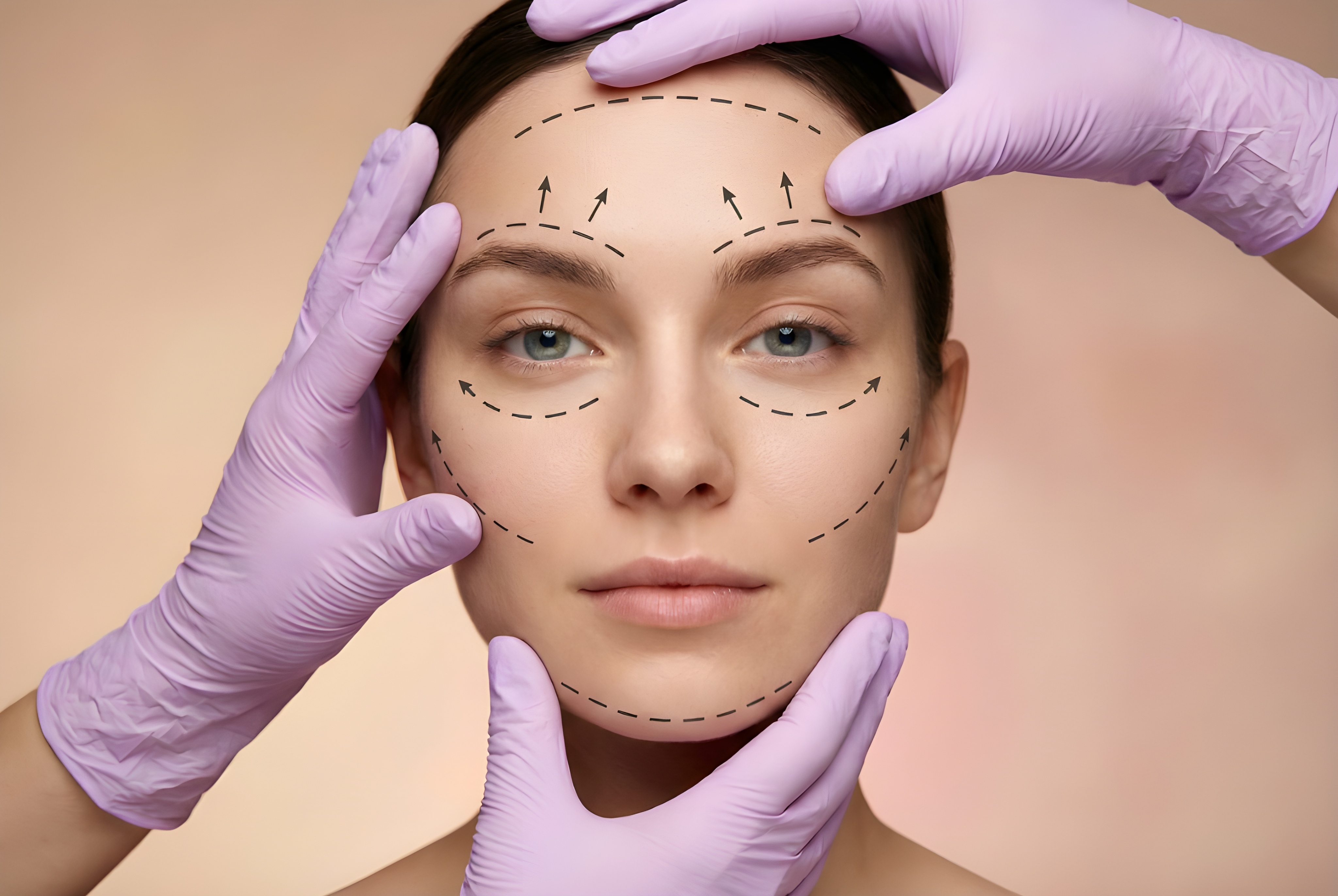 What is “Facial Balancing” and How Does It Create a More Natural Look Than Standard Fillers?