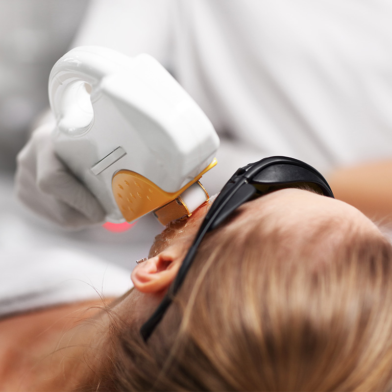 Eine Frau in der Behandlung der ICE Diodenlaser Behandlung.