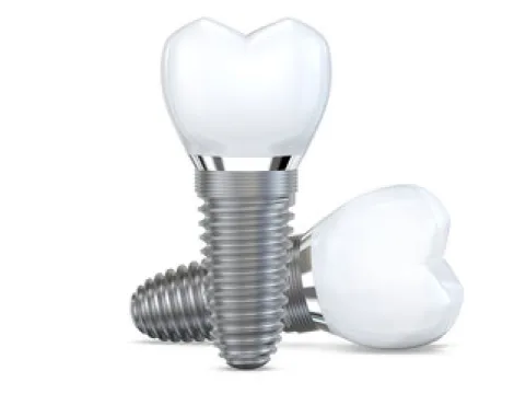 A pair of dental implants on a white background.