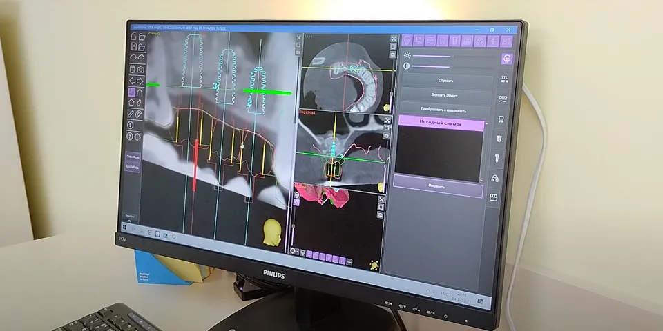 A computer monitor sitting on top of a desk.