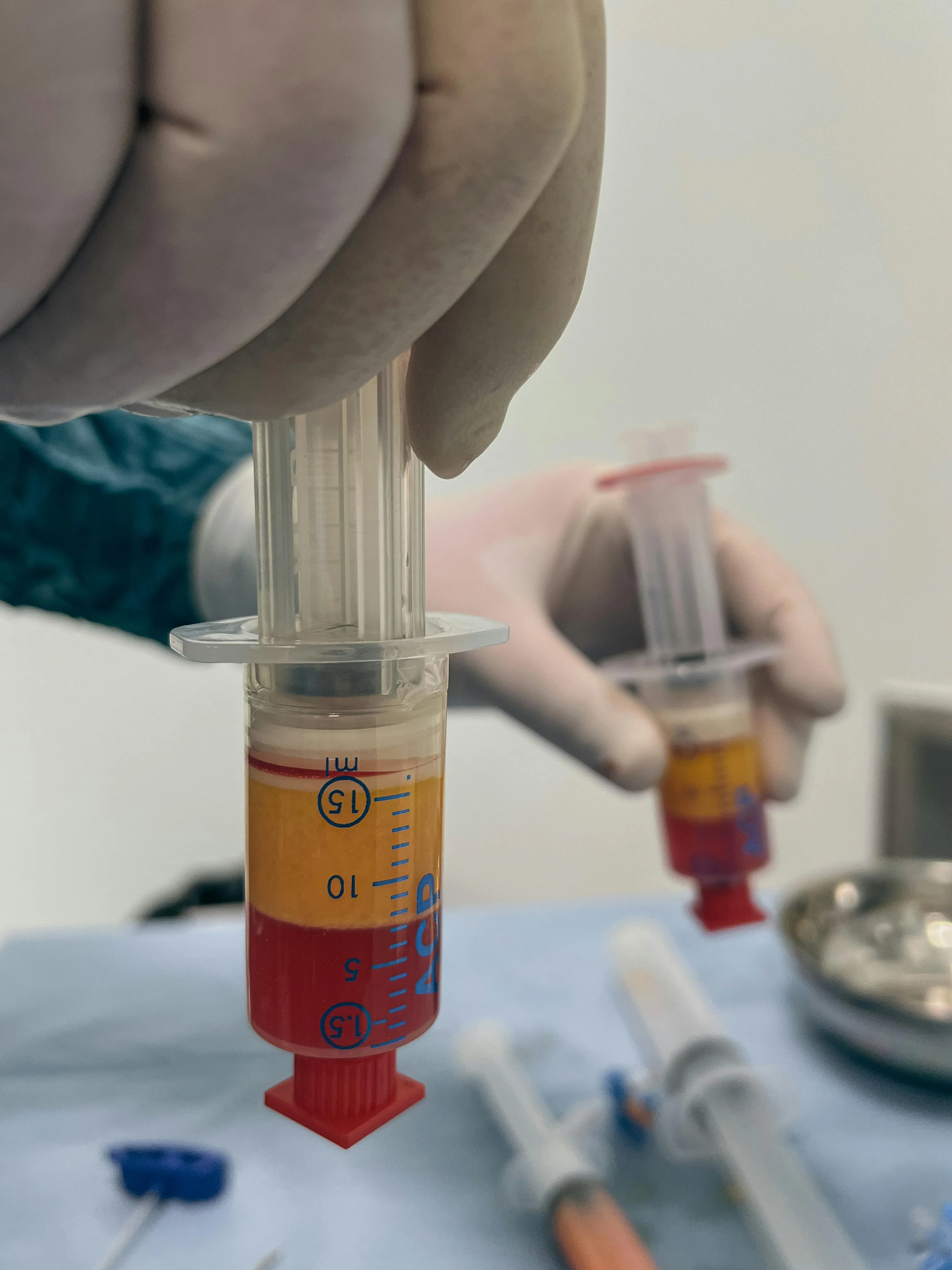 Platelet Rich Plasma Limerick