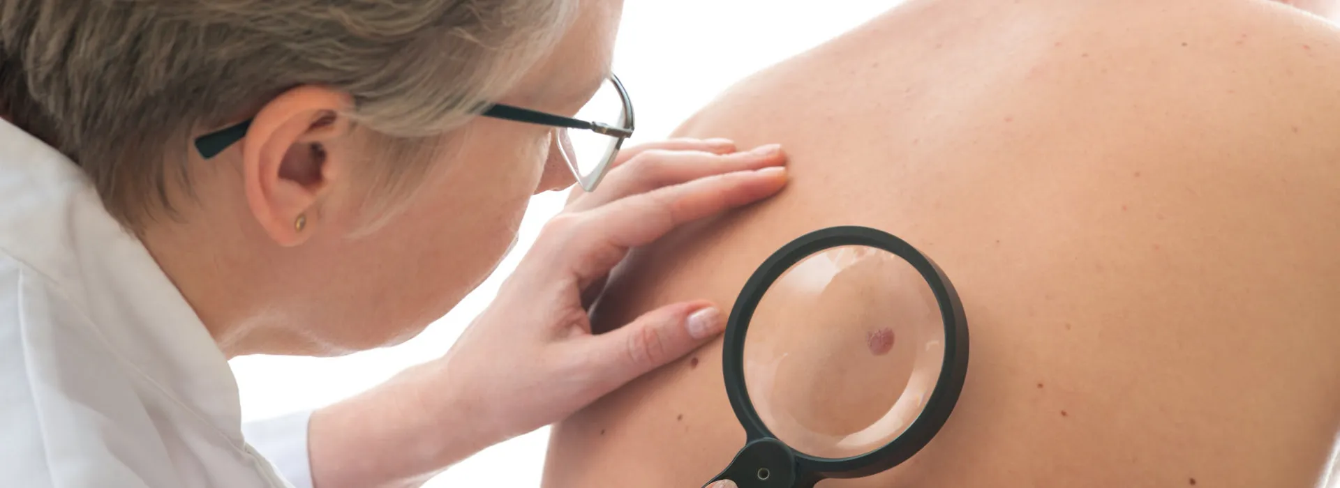 Mole & Skin Lesion Analysis / Removal