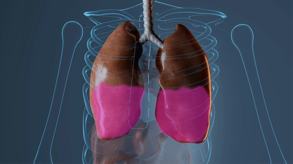 FSD Pharma human body