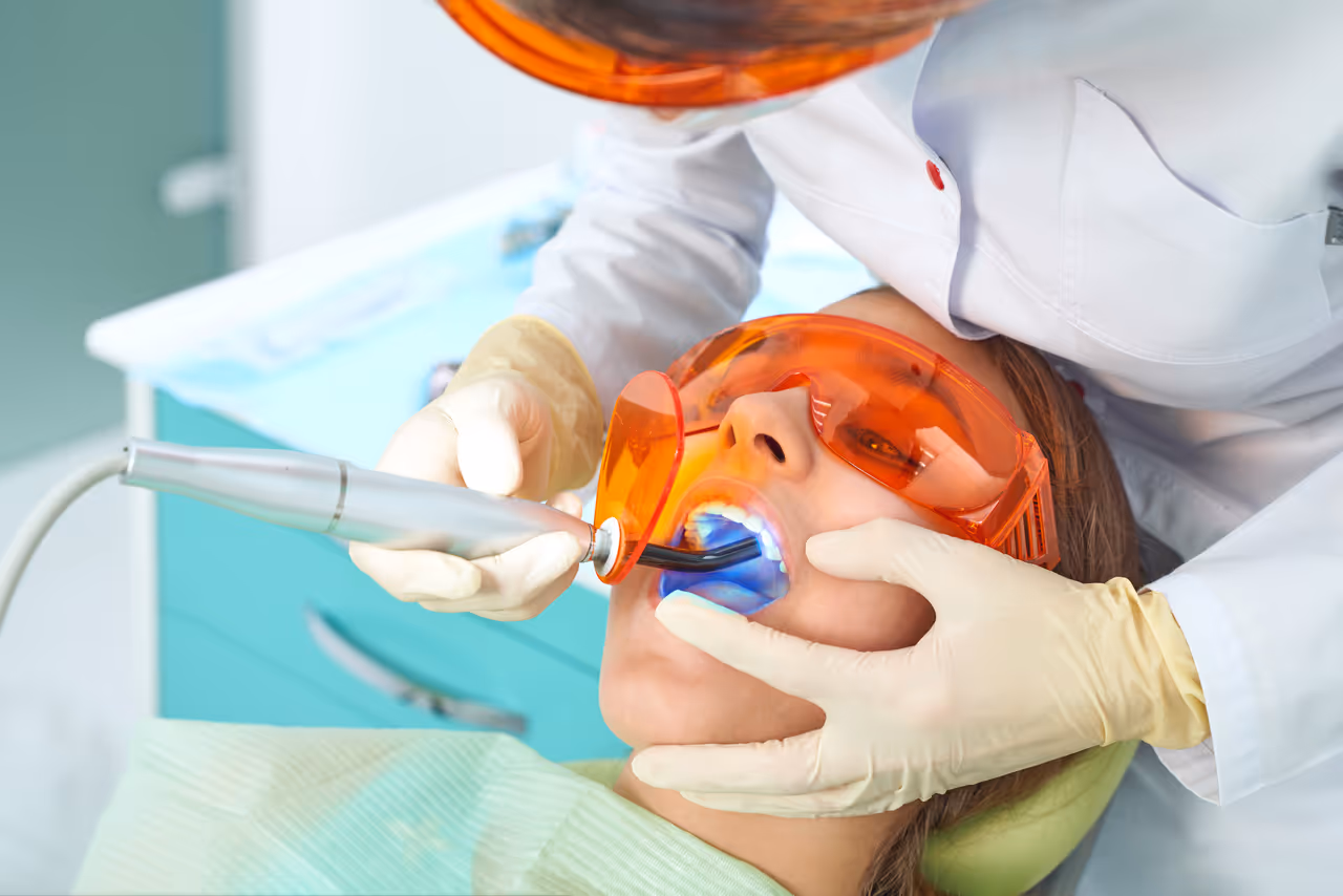 Dental Fillings