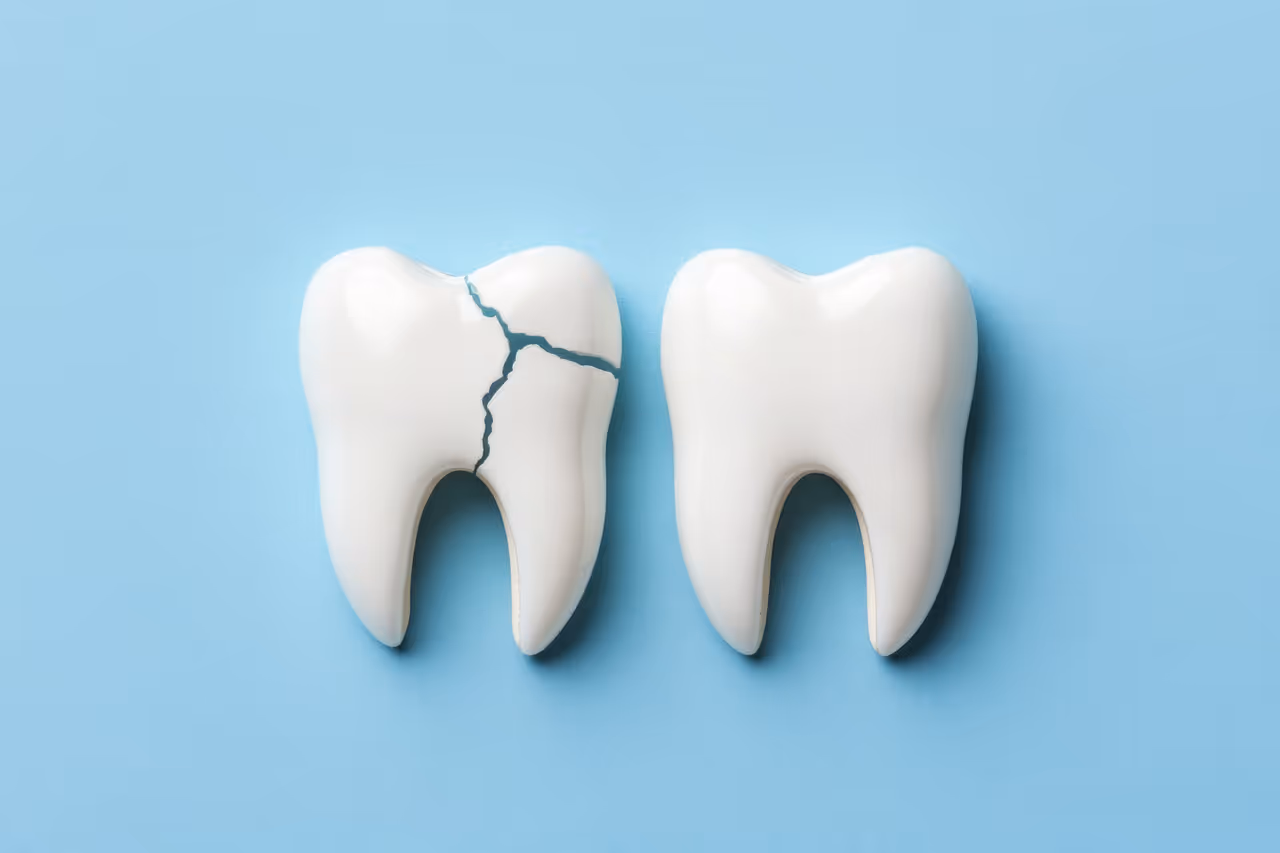 Tooth Repair