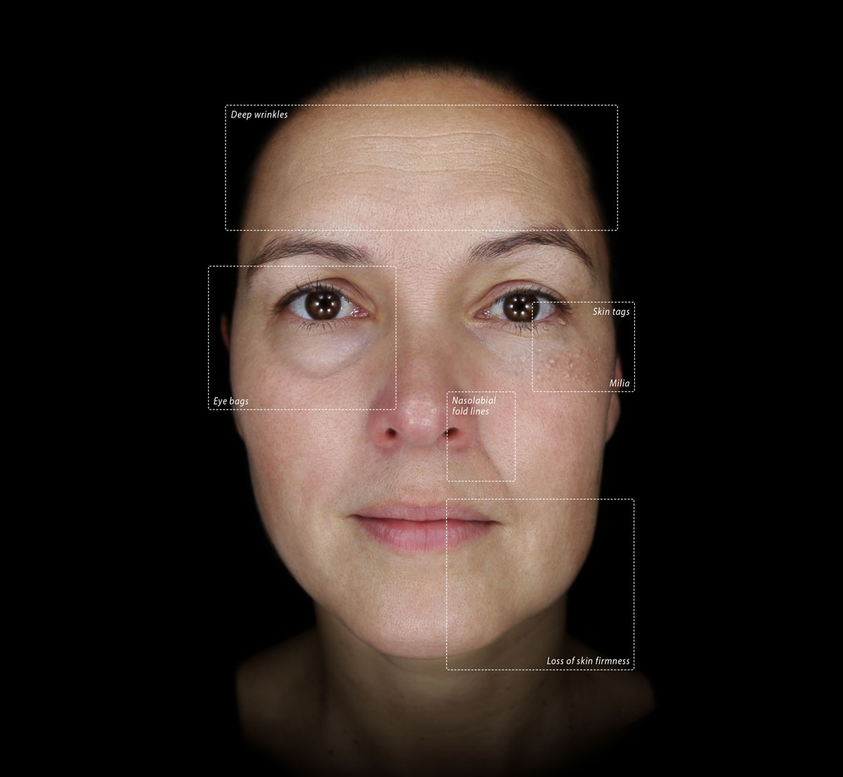 woman receiving skin analysis