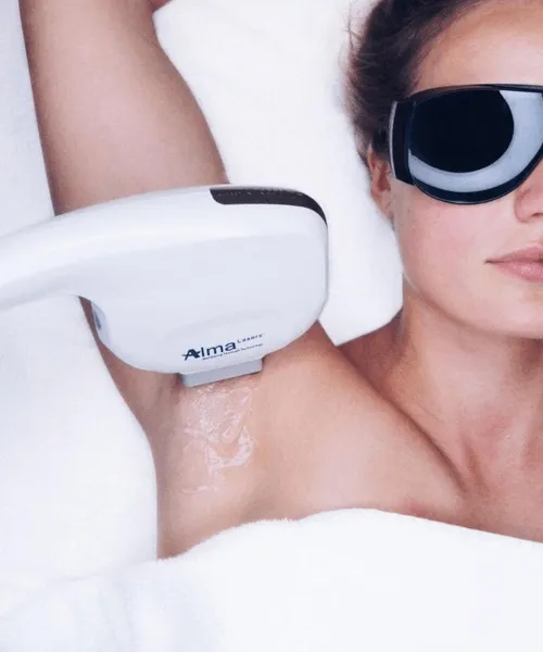 laser hair removal medical spa