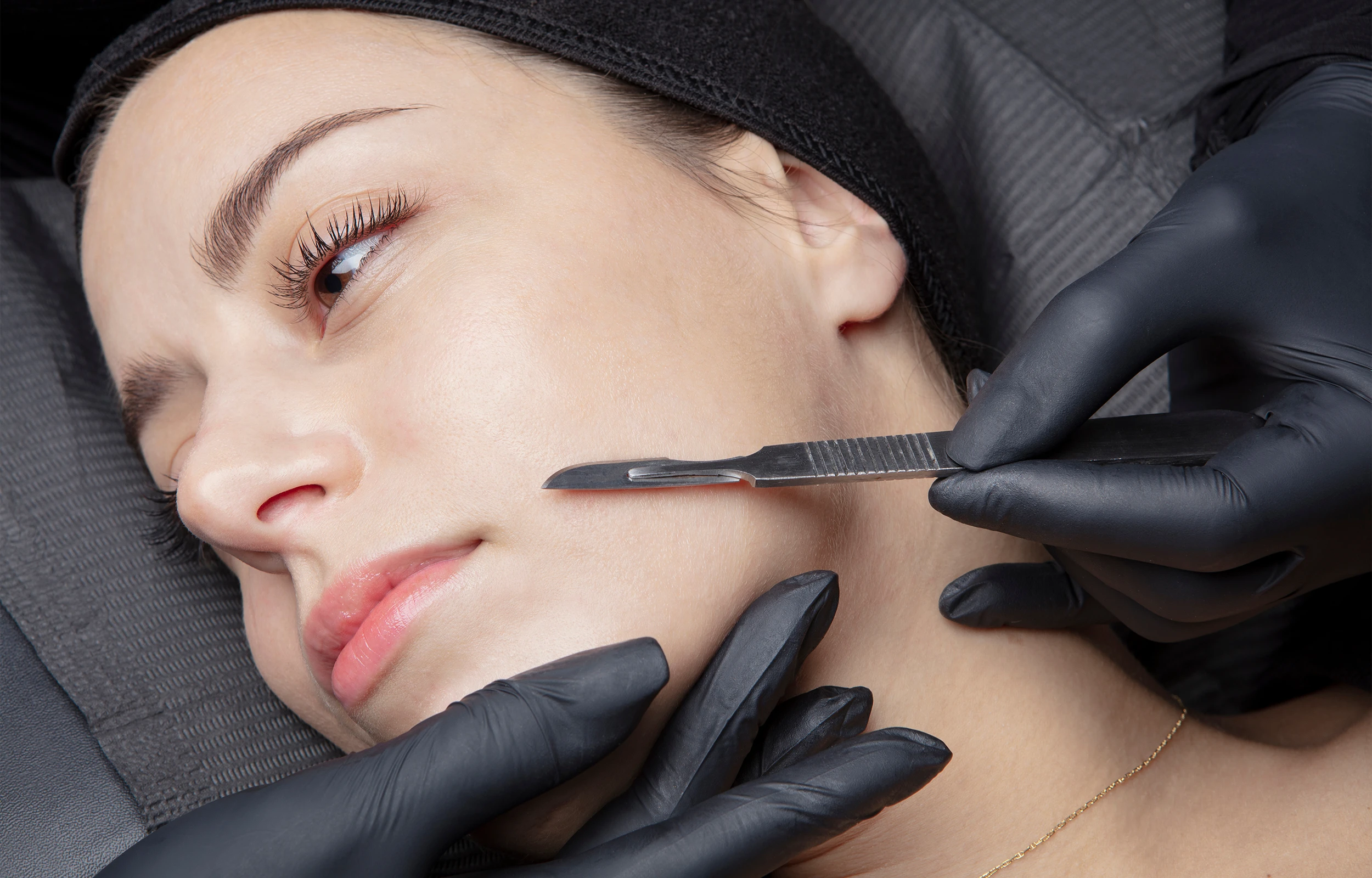 A woman getting dermaplaned at medical spa