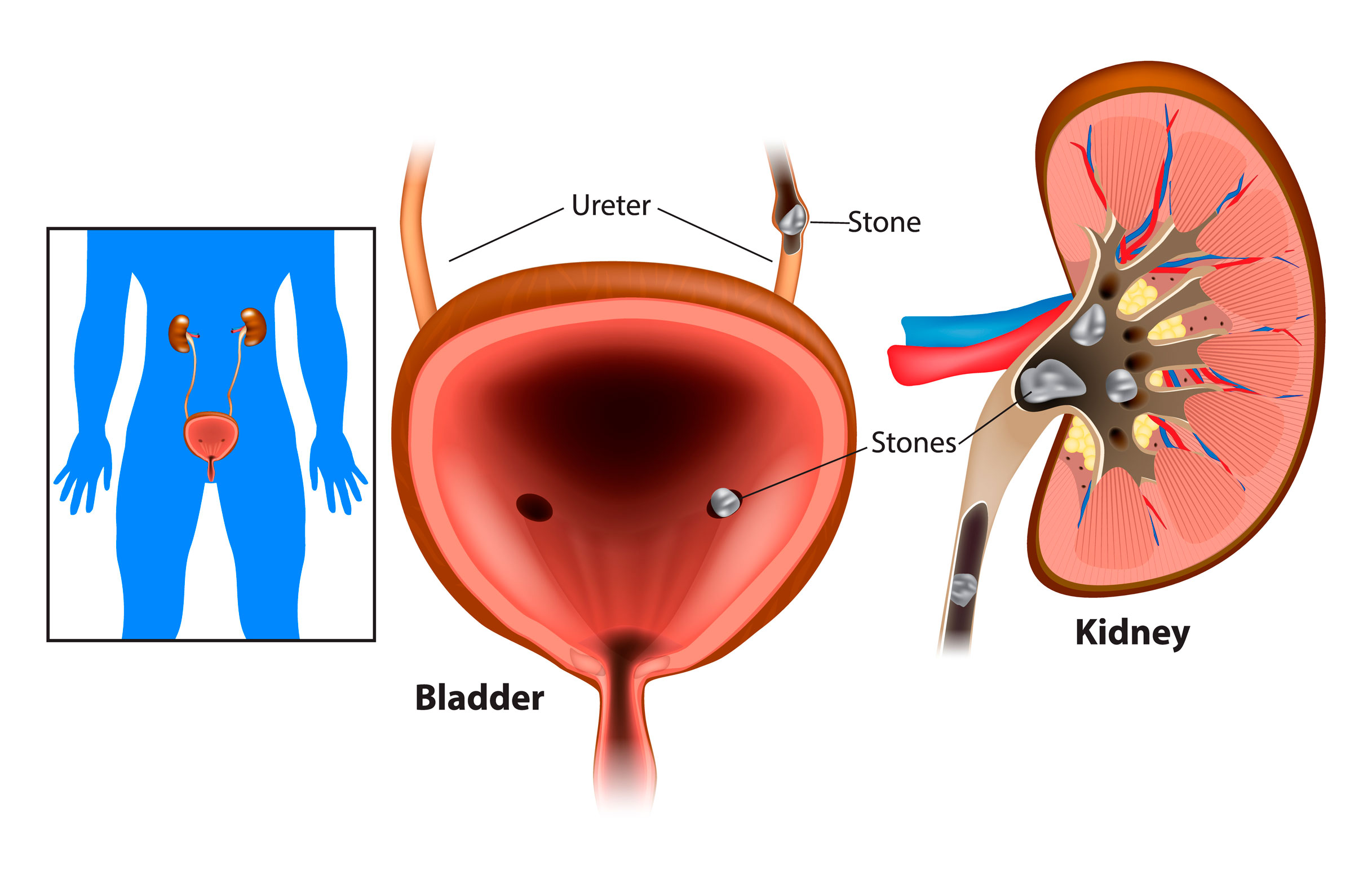 Understanding Urology: The Medical Specialty Focused on the Urinary Tract