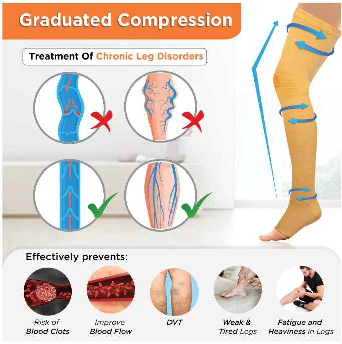 graphic illustrating how graduated compression helps with the treatment of chronic leg disorders