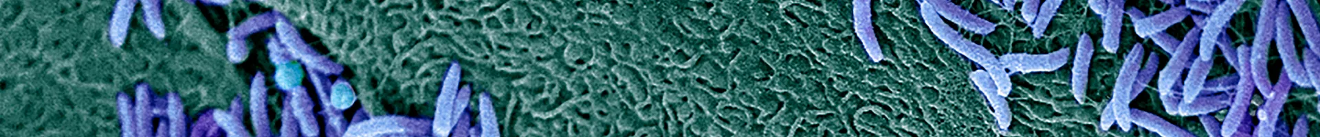 microscopic image of bacteria on the vaginal wall