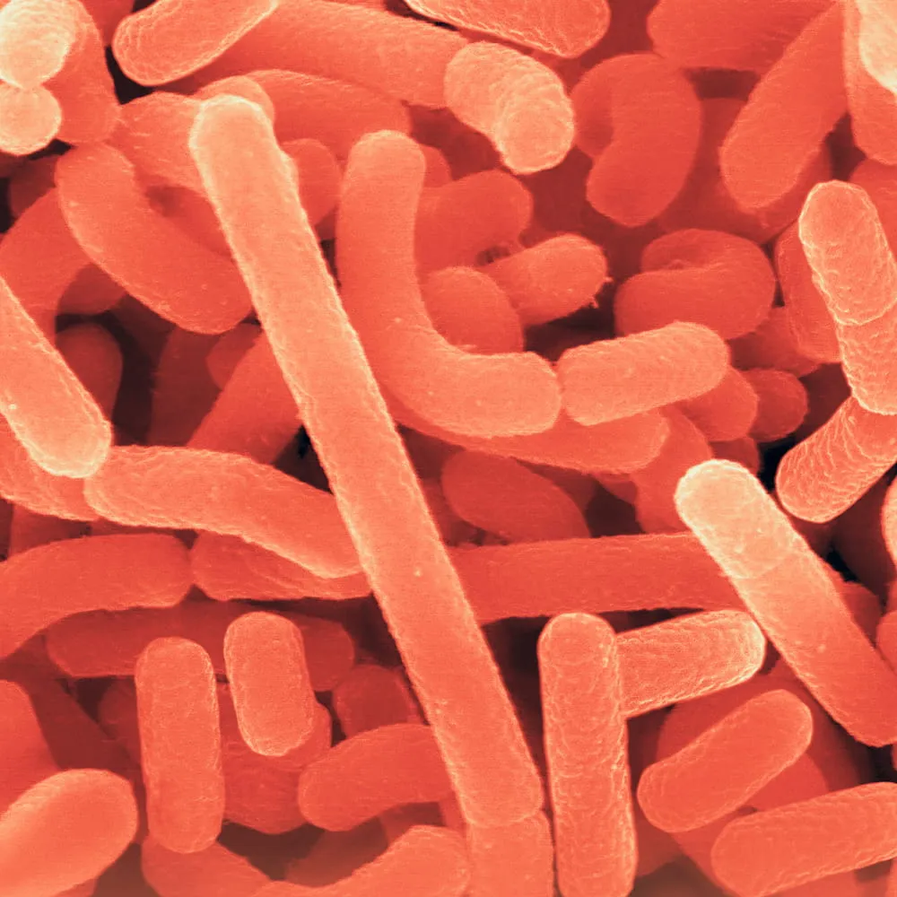 A micrograph of bacteria