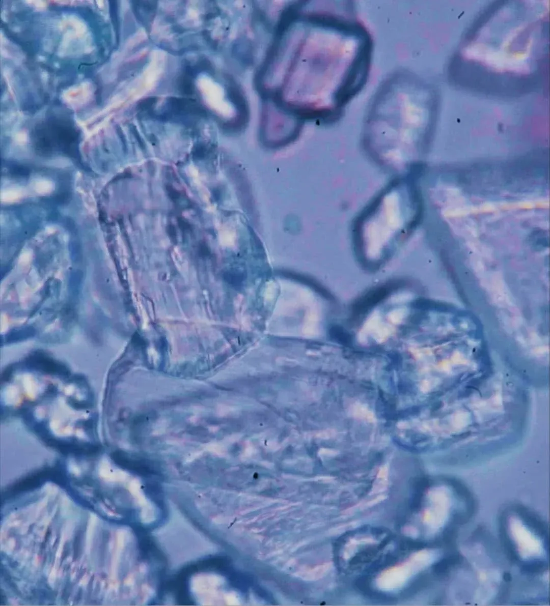 Crystals under a microscope
