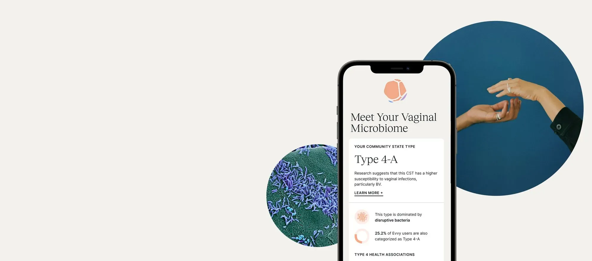 A screenshot of Evvy's sample report that says Meet Your Vaginal Microbiome