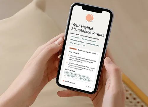 A phone with the test results on them.