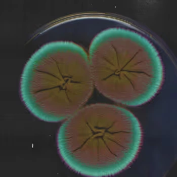 Microbiome Diversity Score