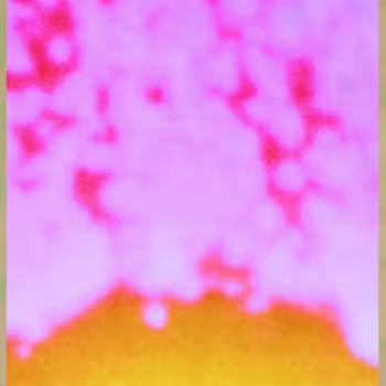 Fertility Disruptors