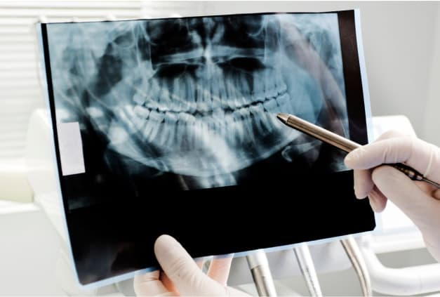 photo of a dentist holding a dental x-ray