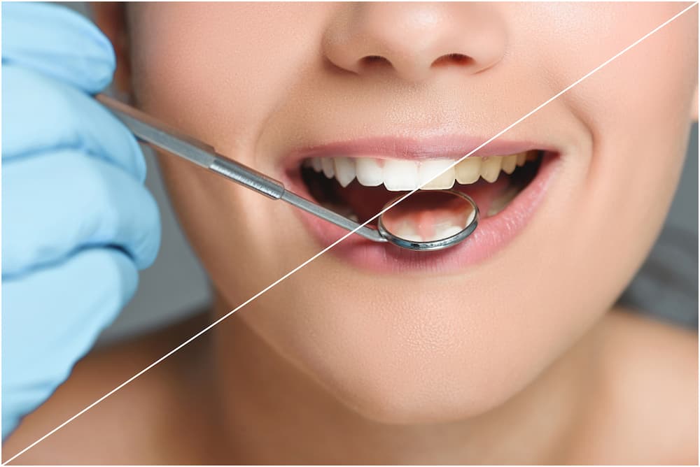 photo of a female patient getting her teeth examined by a dentist