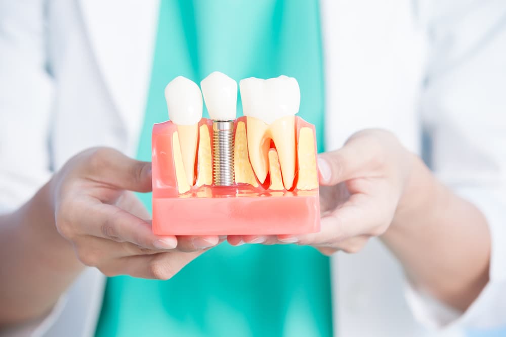 photo of a dentist holding a model of teeth and a dental implant