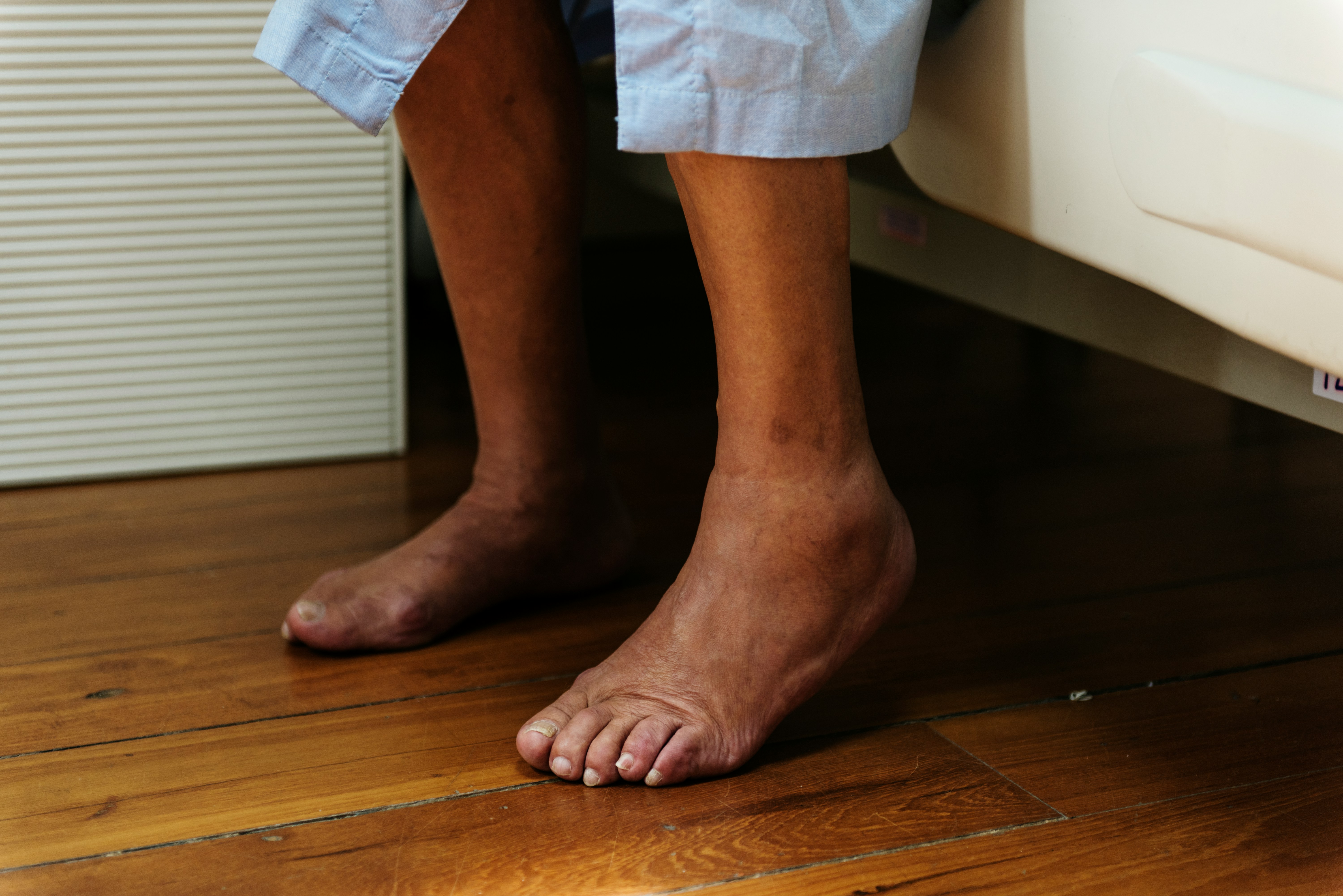 A close up of a person's legs. They are getting out of bed.
