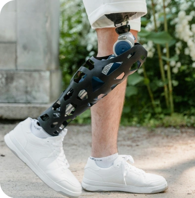 Are You a Candidate For Knee Replacement?