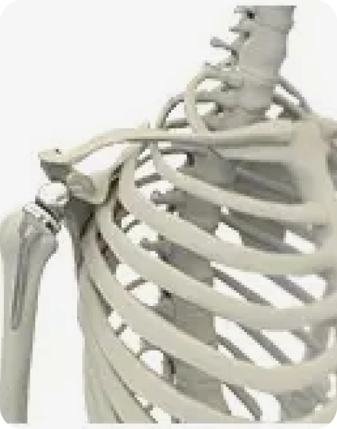 Reverse Shoulder Replacement