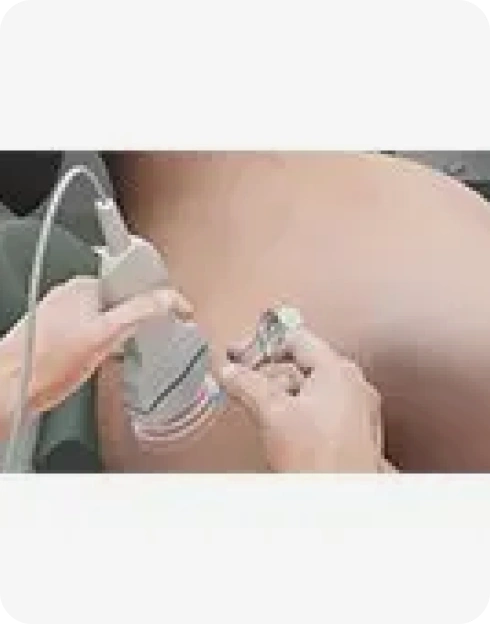 Ultrasound-Guided Shoulder Injections