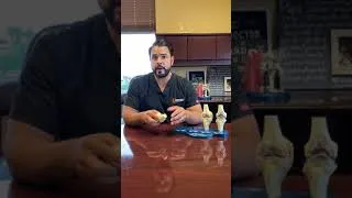 Dr. Jimenez Explains Knee Arthritis