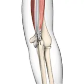 Triceps Tendon Repair