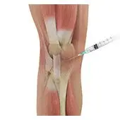 Knee Injections