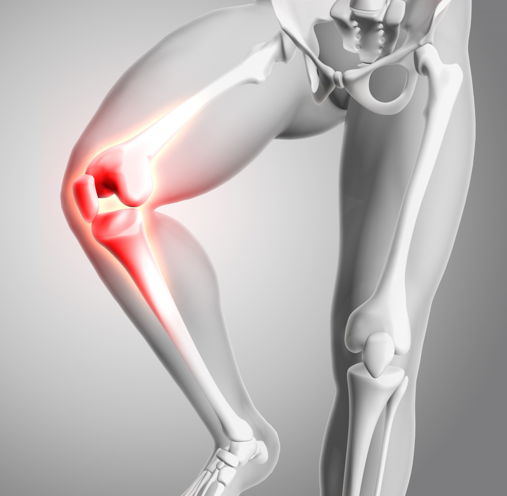 What Does an ACL Tear Feel Like? Signs You Should Not Ignore