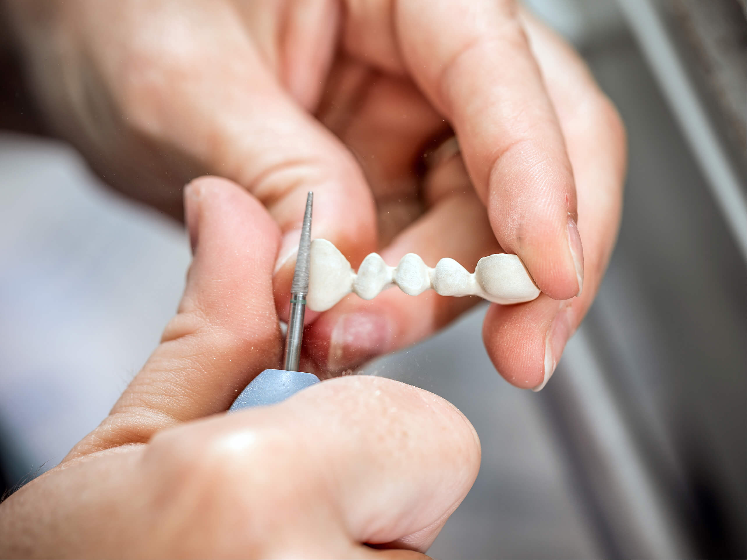 Close-up of a dentist’s hands holding a dental shade guide to compare tooth color for veneers or crowns, showing precision in cosmetic dentistry.
