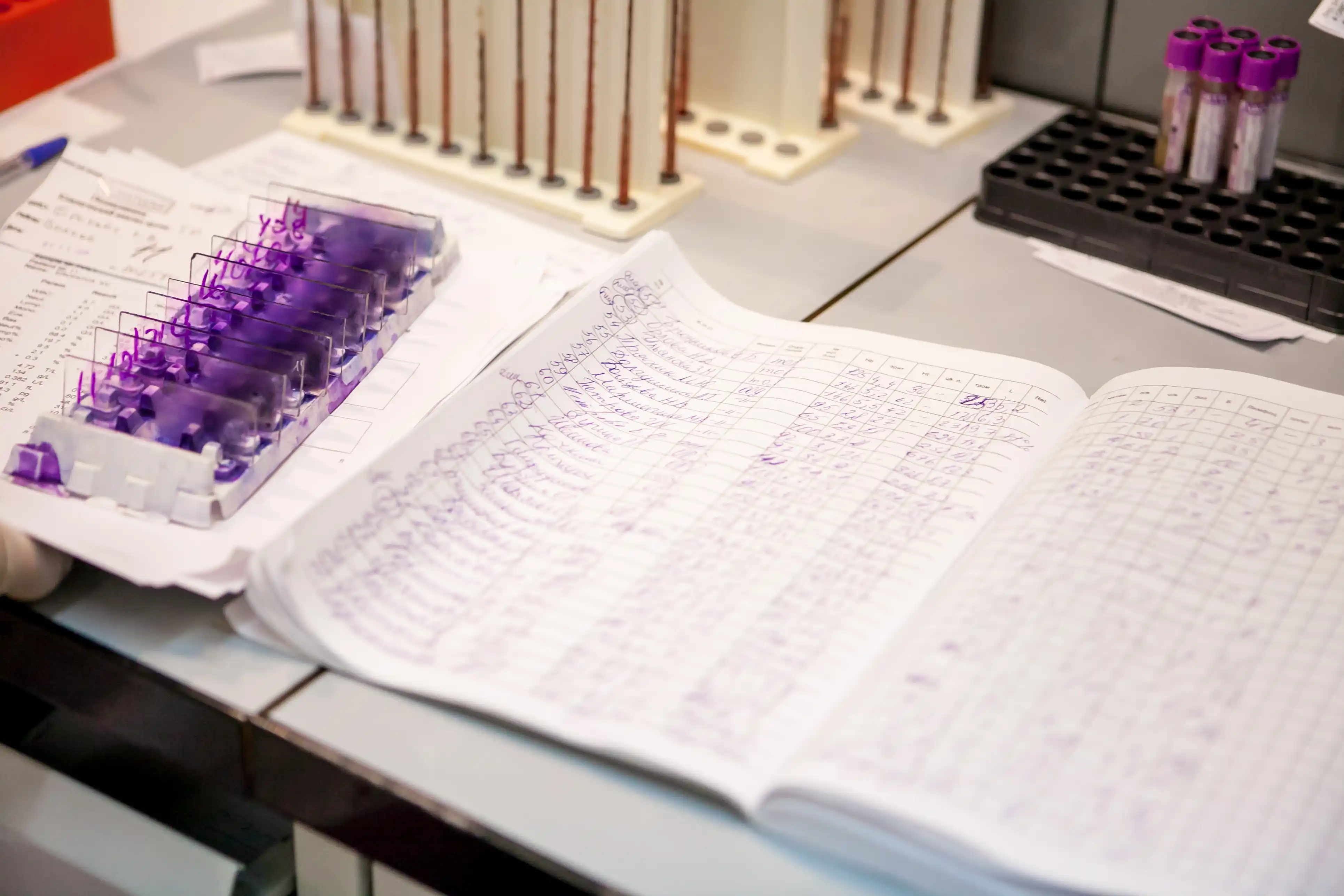Open laboratory notebook with detailed handwritten experimental records next to microscopy slides and sample tubes on a research lab bench.